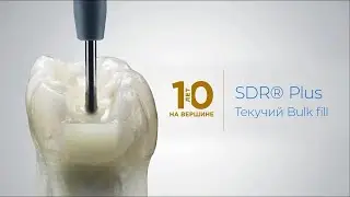 SDR plus - текучий композит объемного внесения!