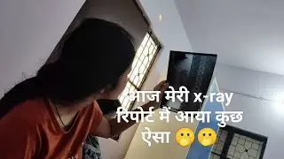 Aaj meri x-ray ki report mai aaya kuch esa 🤌🏻🫢🫢#vlogs #mithi #familyvlogs #sweta'svlogs