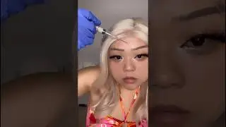 ASMR injecting my face with filler 