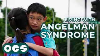 Living with Epilepsy and Angelman Syndrome