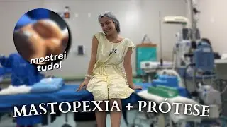 VLOG DA MINHA CIRURGIA | mastopexia com prótese + pós operatório
