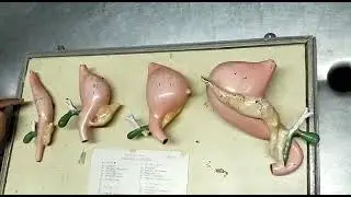 Midgut Loop Rotation [Embryology]