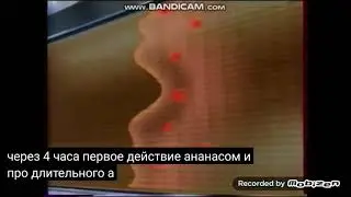 loreal revitalift 2005 реклама