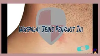 Waspadalah dengan 5 Jenis Penyakit Kulit Ini