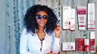 Acne Out Biotrade Cosmeceuticals 1year Update Review | Before & After use