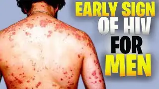 Early Signs Of Hiv For Men