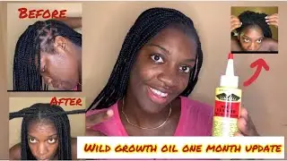 I Used Wild Growth Oil For ONE MONTH!MASSIVE HAIR GROWTH 2021