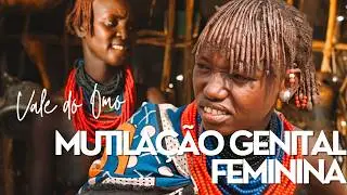 A chocante realidade das meninas na Etiópia! MUTILAÇÃO GENITAL FEMININA atinge 65% das mulheres