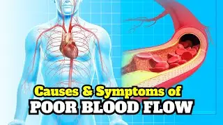 Causes & Symptoms of Weak Blood Circulation | Learn How to Overcome |