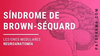 Síndrome de Brown-Séquard (Lesiones medulares). Neuroanatomía para estudiantes de medicina.