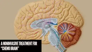 Stimulating gamma brain waves may protect cancer patients from memory impairment effects of chemo