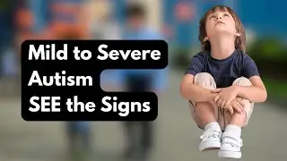 The TRUTH About Autism Levels – Finally Explained Clearly