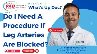 Do I Need A Procedure If Leg Arteries Are Blocked