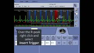 CT ECG Editing Scenario