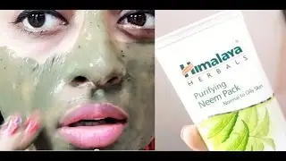 Himalaya Neem Face Pack For Acne & Glowing Skin  __ | SuperWowStyle