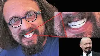 Sam Hyde on His Moustache Hairs