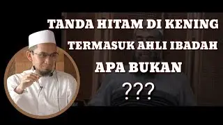 Tanda hitam dikening, apakah termasuk tanda sering sholat...