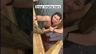 Bridge Jumping Injury