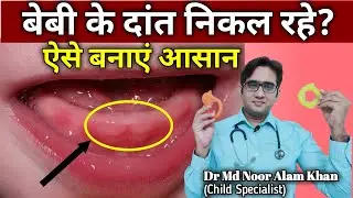 शिशु के दांत निकलना || कुछ ज़रूरी सावधानी || Teething tips for babies || Dr Noor Alam Khan