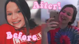 GETTING MY BRACES OFF AFTER 2 YEARS!!!