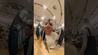 FIZ IMPLANTE PRA DEIXAR DE SER CALVO!