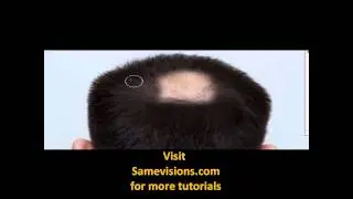 Tutorial 1 : Fix hair loss issue with Photoshop CS5
