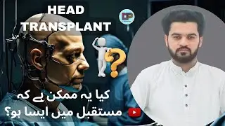 Is It Possible to do a Head Transplant?