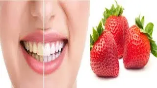 How to Whiten Teeth with Strawberries