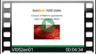 DynaMesh®-CICAT visible - OR-Video: Closure of Midline Laparotomy with a Prophylactic Mesh