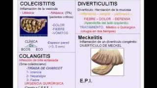 ABDOMEN AGUDO INFLAMATORIO.flv