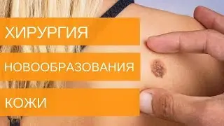 НОВООБРАЗОВАНИЯ КОЖИ