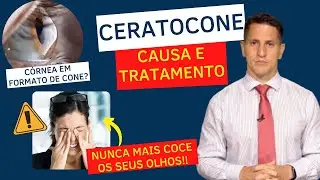 CERATOCONE: O MOTIVO PARA VOCÊ NÃO COÇAR MAIS OS OLHOS | Dr. Arthur Farache