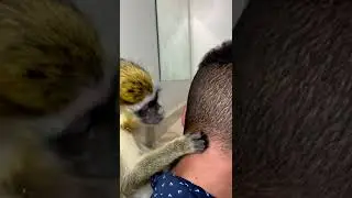 Black head removal on face - Blackheads on back treatment