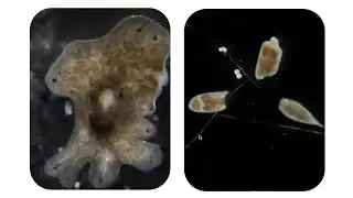 Worms, regeneration powers, and immortality — Amelie Raz — MIT Museum Talks