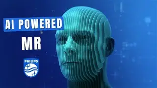 Philips SmartSpeed ai powered magnetic resonance imaging application (3D animation 2024)