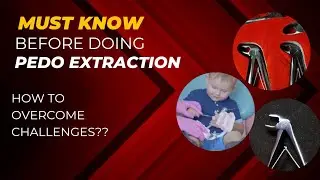 Expert Tips: Child Tooth Extraction Forceps Usage