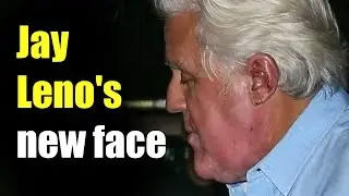 Jay Leno's new face