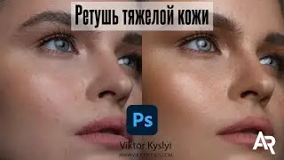 How to retouch bad skin? Complex skin retouching in Photoshop. Frequency separation.