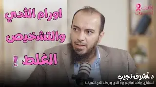 أورام الثدي والتشخيص الغلط د.أشرف نجيب والمخرج محمد رائد