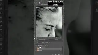 How to remove acne in Photoshop