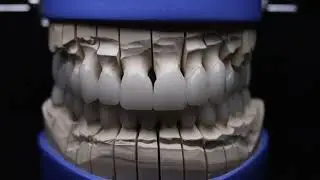 All On X Dental Studio B Roll