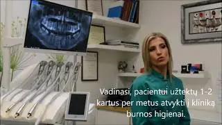 Dantų laminatės ar estetinis  plombavimas ? Ką pasirinkti? (Holivudinė šypsena pasiekiama ranka)