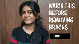 Things to Know Before Your Braces Removal Day | TAMIL 