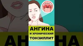 TONSIGNA AND CHRONIC TONSILLITIS