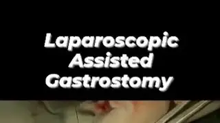 Laproscopic Assisted Gastrotomy! A quick learning video ! #surgeonlife #medicalstudent #surgeryday