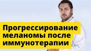 Иммунотерапия при меланоме и ее прогрессирование