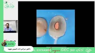 مع النجم العراقي دكتور حيدر رزاق   TOOTH SAVING , BETWEEN PROPAGANDA & REALITY 🔥🔥