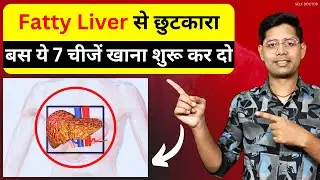 फैटी लीवर के लिए 7 रामबाण घरेलू उपाय | fatty liver me kya khana chahiye | SELF DOCTOR