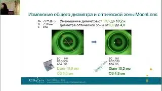 Оптометрический форум 2024: Глущенко Е.А. «Пять шагов к успеху ... с использованием линз MoonLens»