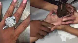 Ning Baizura kongsi cerita minta bantuan bomba pasal cincin bentuk ikan terlekat di jari